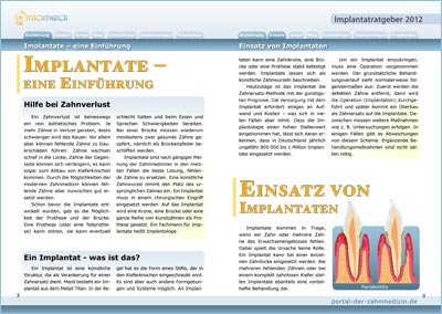 Implantat Ratgeber 1 - Innenteil