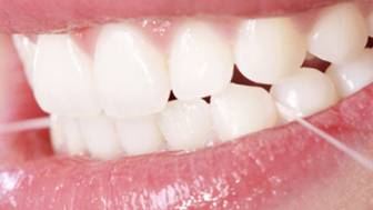 20110107-Zahnfleischbluten verhindern