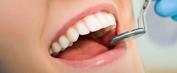 Was kostet die Professionelle Zahnreinigung