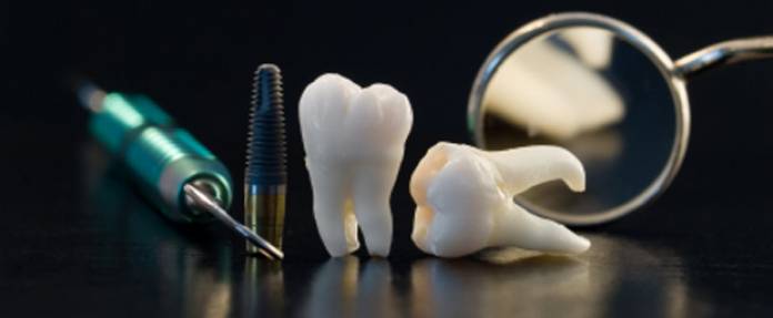Alles über Zahnprothesen
