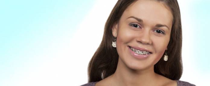 Zahnkorrektur mit Zahnspangen auch im Erwachsenenalter