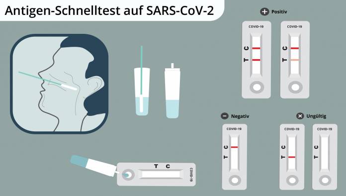 Antigen-Schnelltest auf SARS-CoV-2