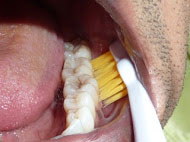 Zähne putzen mit getaplus-unicus Schallzahnbürste